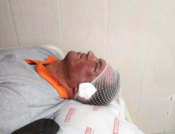  Kdz. Ereğli Belediyesinde belediye işçisine saldırı – Birlik Haber Ajansı
